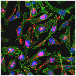 AAV labeled with a cyanine dye are seen as red particles in HeLa cells. The cell nuclei is stained with Hoechst (blue) and the cadherin molecule is stained in green for contrast