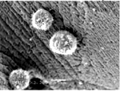 Specific binding of human acute myeloid leukemia cells on cryogel matrix